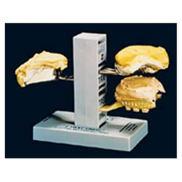 Z-Tray Tree Impression Tray Holder 6 in x 5.5 in x 3.5 in Ea