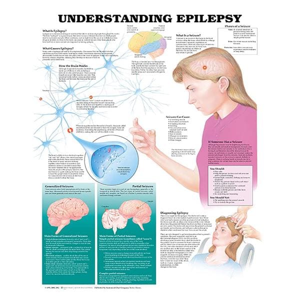 Understanding Epilepsy 20x26" Educational Chart EA