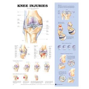 Knee Injuries 20x26" Anatomical Chart Ea