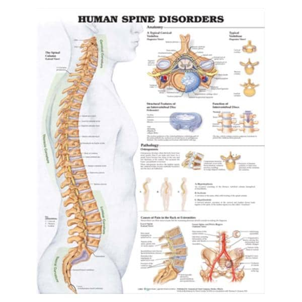 Human Spine Disorders 20x26" Educational Chart Ea