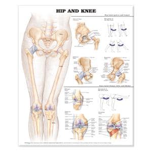 Hip And Knee 20x26" Anatomical Chart Ea