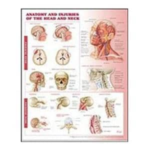 Anatomy and Injuries of the Head and Neck 20x26" Anatomical Chart Ea