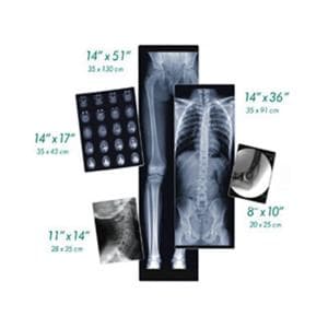 DirectVista X-Ray Film 14 in x 51 in Blue Ea