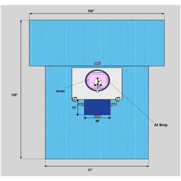 102x120x77" Sterile Sheet Drape Fenestrated