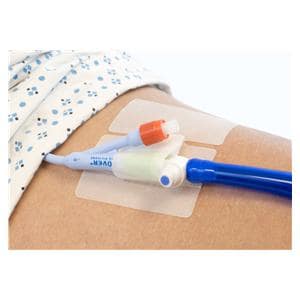 Cath-Secure Catheter Tube securement device