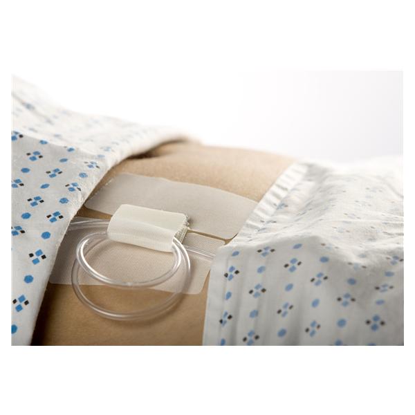 Cath-Secure Catheter Tube securement device