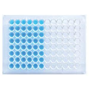 ELISA Anti-SSA Test Kit 96 Count Ea