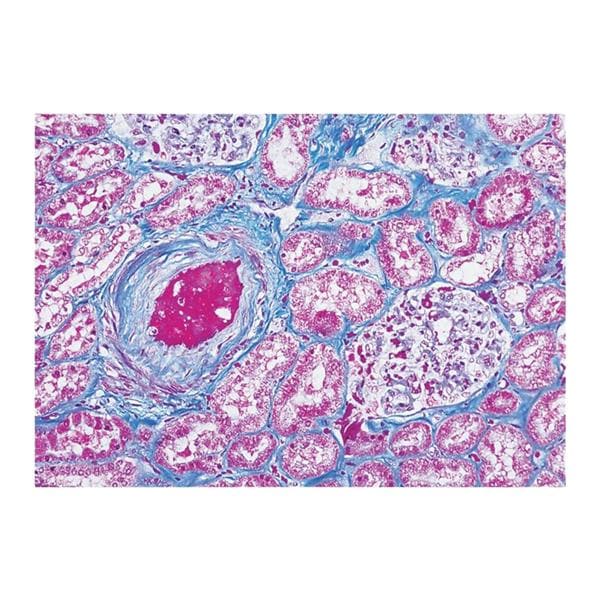 Masson's Trichrome Stain Kit Ea