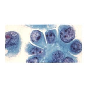 Reticulocyte Stain 125mL Ea