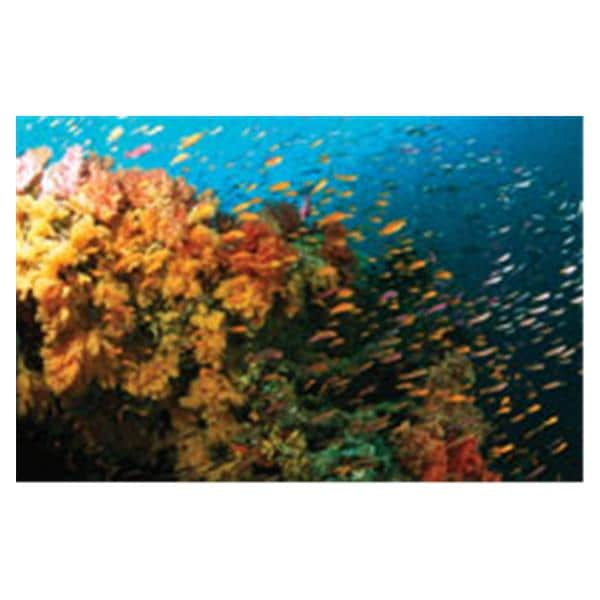 CeilingScenes Acoustic Tile Fiji Reef 2-Tiles Vertical 24 in x 24 in Ea