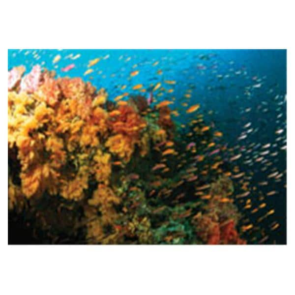 CeilingScenes Acoustic Tile Fiji Reef 1-Tile Square 24 in x 24 in Ea