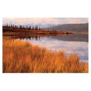 CeilingScenes Acoustic Tile Wonder Lake 2-Tiles Horizontal 24 in x 24 in Ea