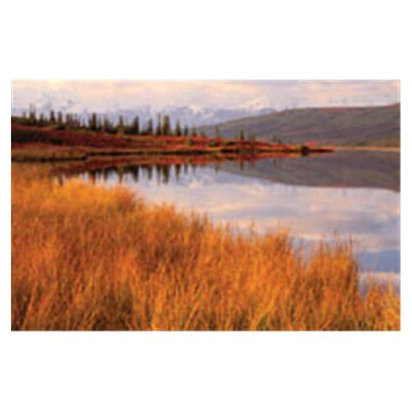 CeilingScenes Acoustic Tile Wonder Lake 1-Tile Horizontal 48 in x 24 in Ea