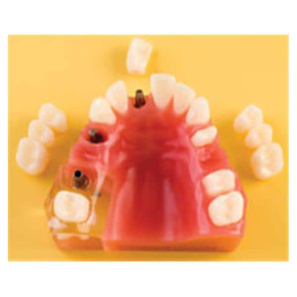 Patient Education Model Implant / Crown and Bridge Ea