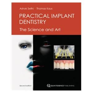 Book Practical Implant Dentistry: The Science and Art 2nd Edition Ea