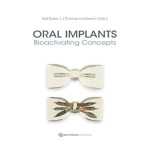 Book Oral Implants: Bioactivating Concepts Ea