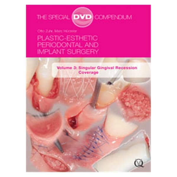 DVD Plastic-Esthetic Perio Imp Volume 3 Ea