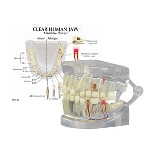 Patient Education Model Human Jaw 2 4/5 in x 2 1/2 in x 2 1/2 in Ea