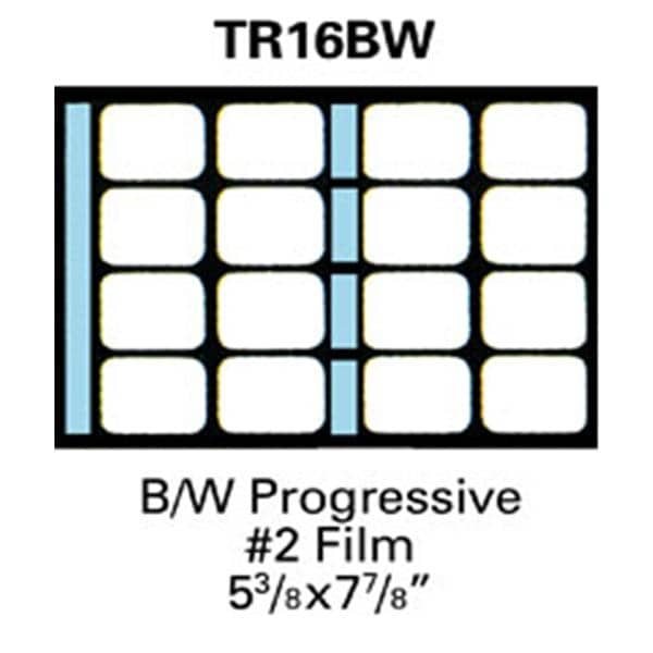 TrollMount X-Ray Film Mounts TR16BW #2 Plastic 100/Bx