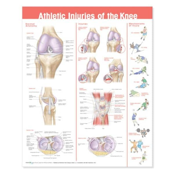 Knee Injuries 20x26" Educational Chart Ea