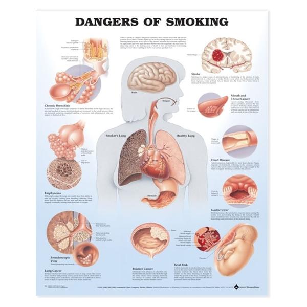 Dangers of Smoking 20x26" Educational Chart EA