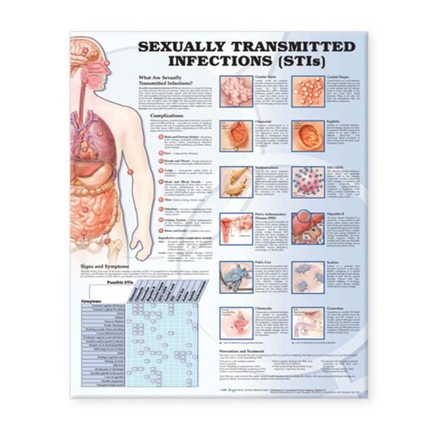 Sexually Transmitted Infections 20x26" Educational Chart Ea