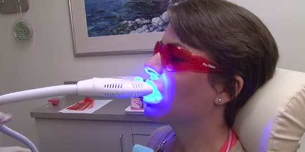 Teeth Whitening - Henry Schein