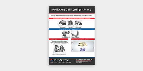 Immediate Denture Scanning