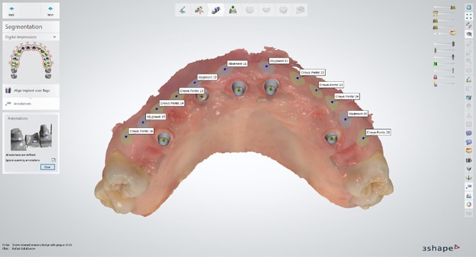 3Shape-Dental-System-2024_image-03