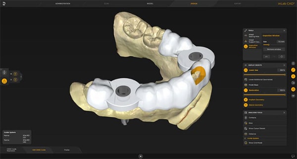 inLab CAD Software - Zahn Dental Labs