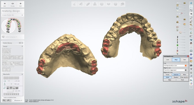 3Shape-Dental-System-2024_image-01